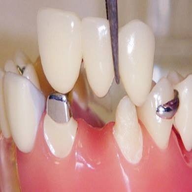 dental_surgery_virat_dental_clinic