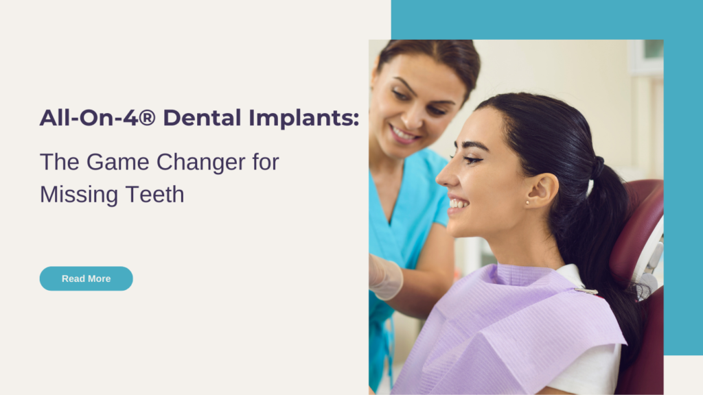 All-On-4® Dental Implants: The Game Changer for Missing Teeth